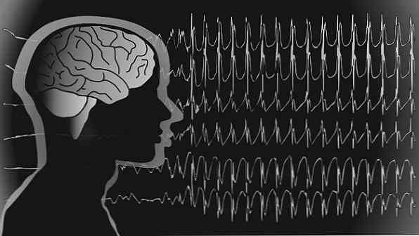 Шта је фотосензитивна епилепсија?