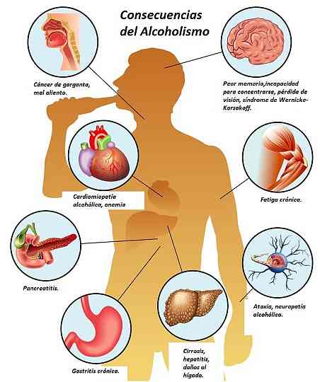 17 Konsekuensi Alkoholisme dalam Kesehatan