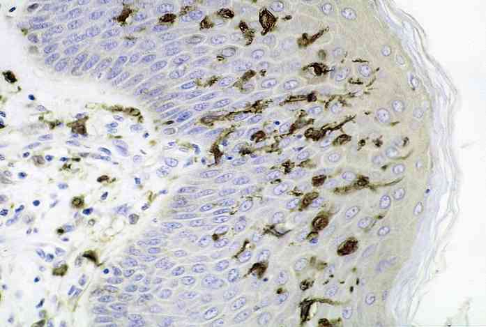 Jenis, Fungsi dan Histologi Sel Dendritik