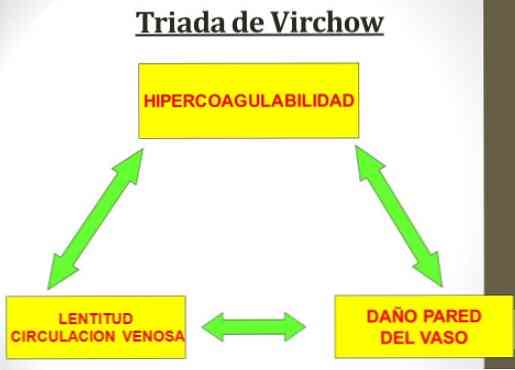 Virchow komponensek és jellemzők triádja
