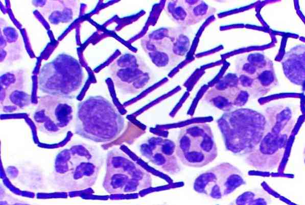 Taksonomi Bacillus anthracis, ciri-ciri, penyakit