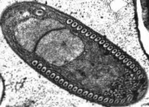 microsporidia paraziták