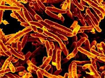 Mycobacterium tuberculosis penyebab tb adalah jenis bakteri yang hidup pada paru-paru manusia bakteri tersebut tergolong