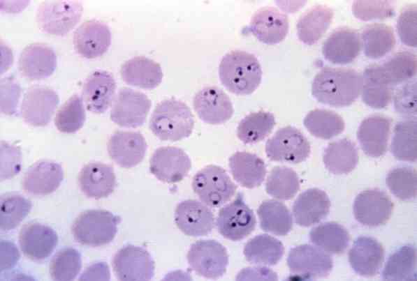 Ciri-ciri Plasmodium falciparum, morfologi, kitaran hidup, gejala