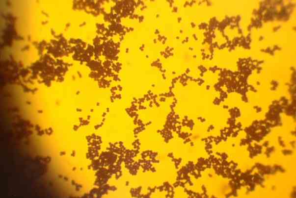 Charakteristika Staphylococcus aureus, morfologie, patogeneze