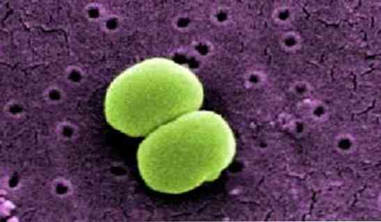 Staphylococcus epidermidis charakteristikos, taksonomija, morfologija