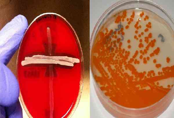 Streptococcus agalactiae charakteristikos, morfologija, patologija