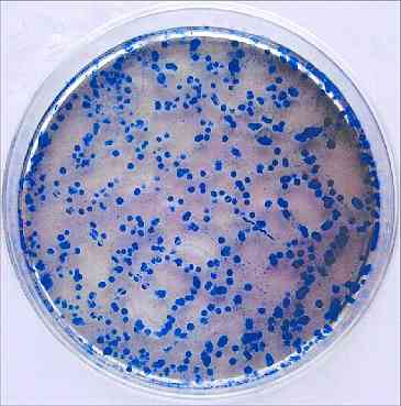 Charakterystyka Streptococcus mitis, taksonomia, pataologías