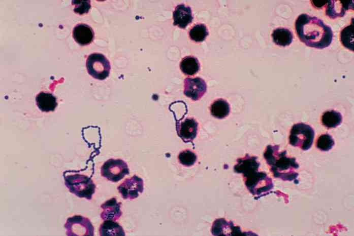 Streptococcus viridans'i omadused, elutsükkel ja sümptomid