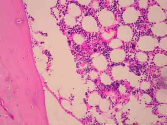 Značilnosti hematopoetskega tkiva, histologija, tipi, funkcije