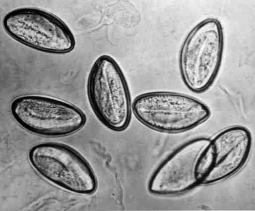 Helminth tojások és enterobiosis, Enterobiasis parazita életciklusa
