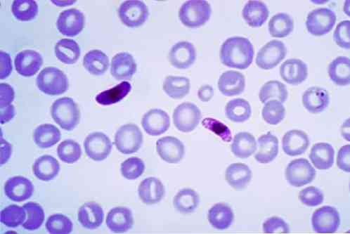 A malária plazmodium stádiumai az eritrocitákban.