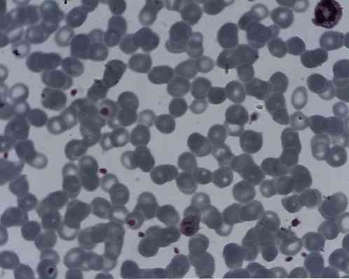 Ciri-ciri plasmodium ovale, taksonomi, morfologi, kitaran hayat