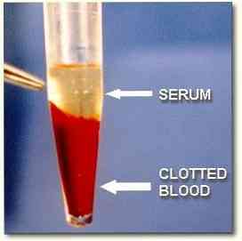 ما هو مصل الدم؟