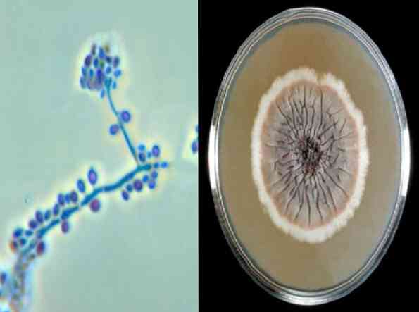 Karakteristik sporothrix schenckii, morfologi, patologi, pengobatan