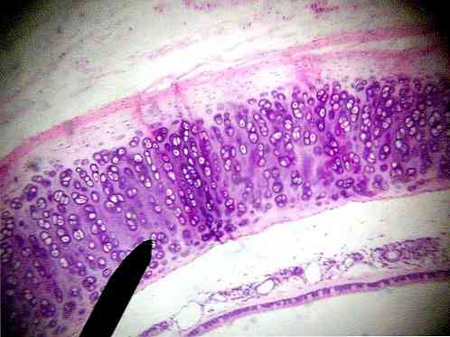 ureaplasma nőknél és ízületi betegségek