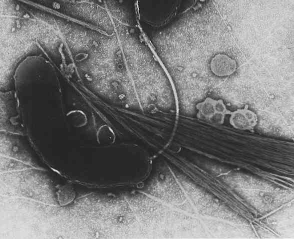 kolera vibrio parazita