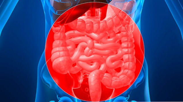 腸管虚血の症状、原因および治療