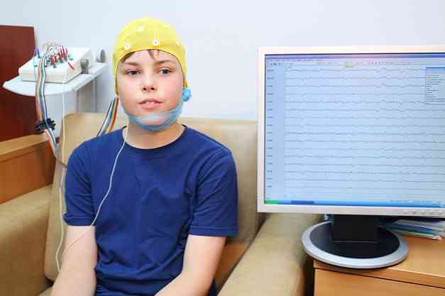 Kas yra elektroencefalograma? (EEG)