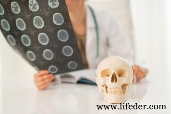 Objawy, przyczyny, leczenie, uraz czaszkowo-mózgowy (TBI)